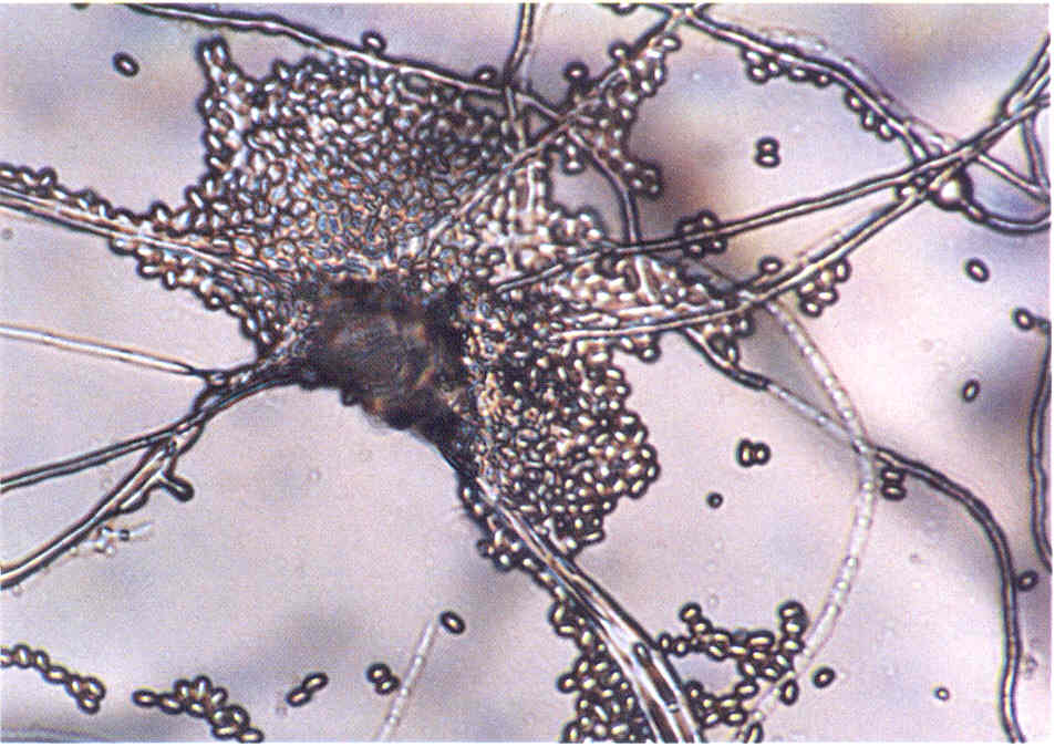 На коже обнаружены споры. Trichophyton микроскопия. Мицелий грибов микроскопия. Мицелий грибов кожи микроскопия. Поверхностная трихофития микроскопия.